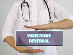 vasectomy-reversal